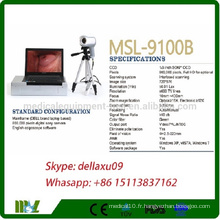 MSL9100B-A Colposcope électronique numérique le moins cher avec la marque Dell Colposcope portable / vidéo pour le vagin